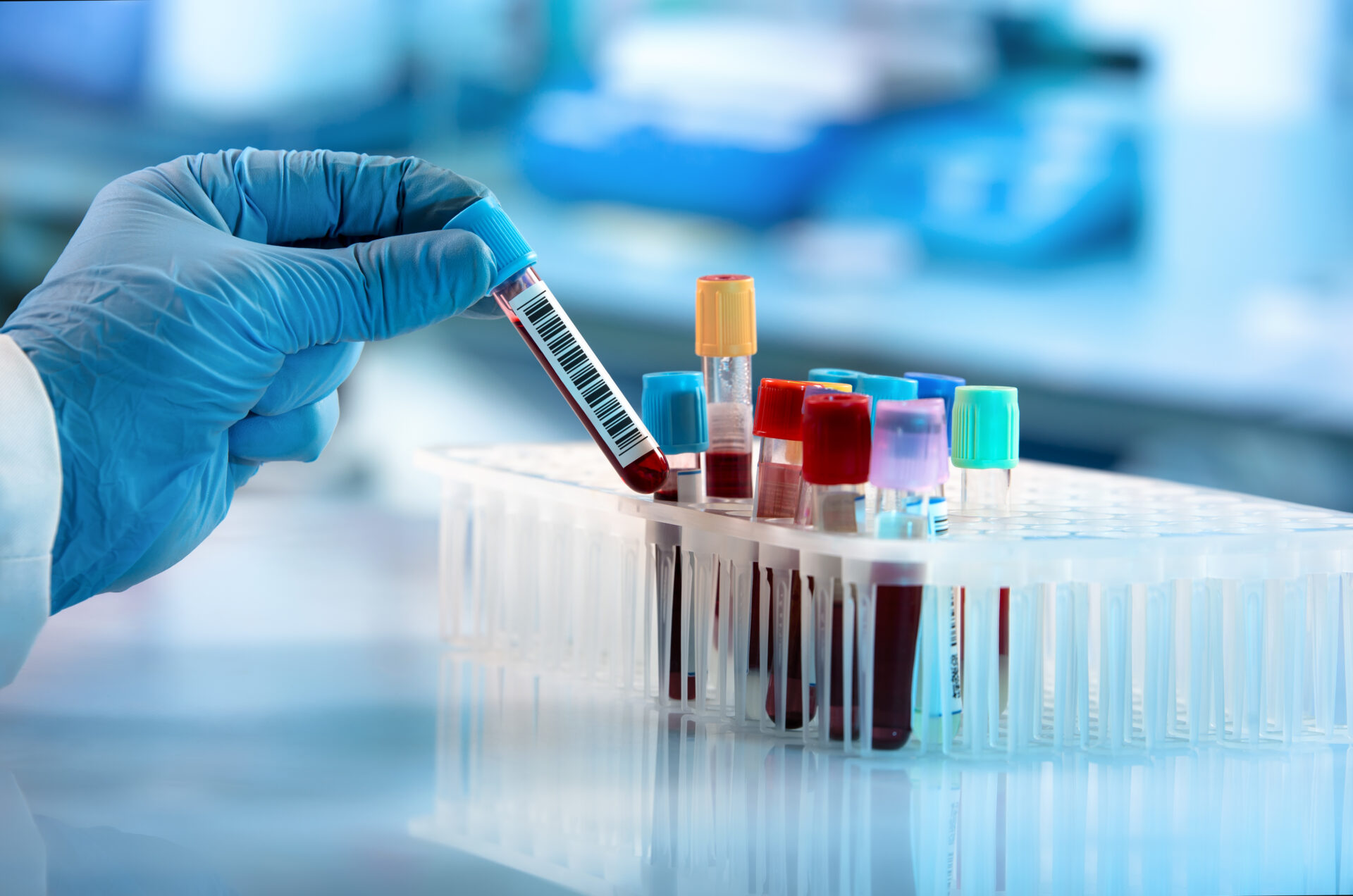 blood analysis Melbourne